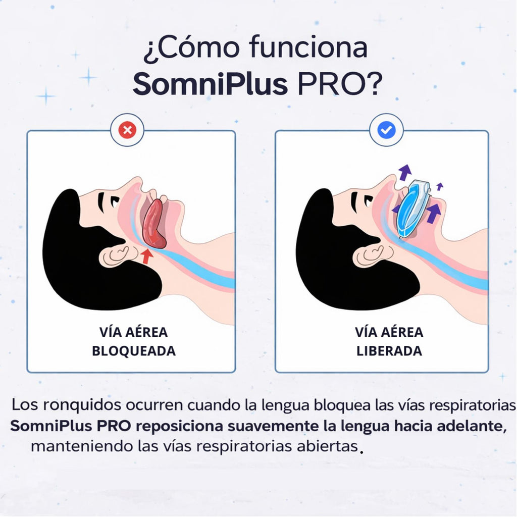 Somniplus Pro - Alivio Inmediato De Los Ronquidos
