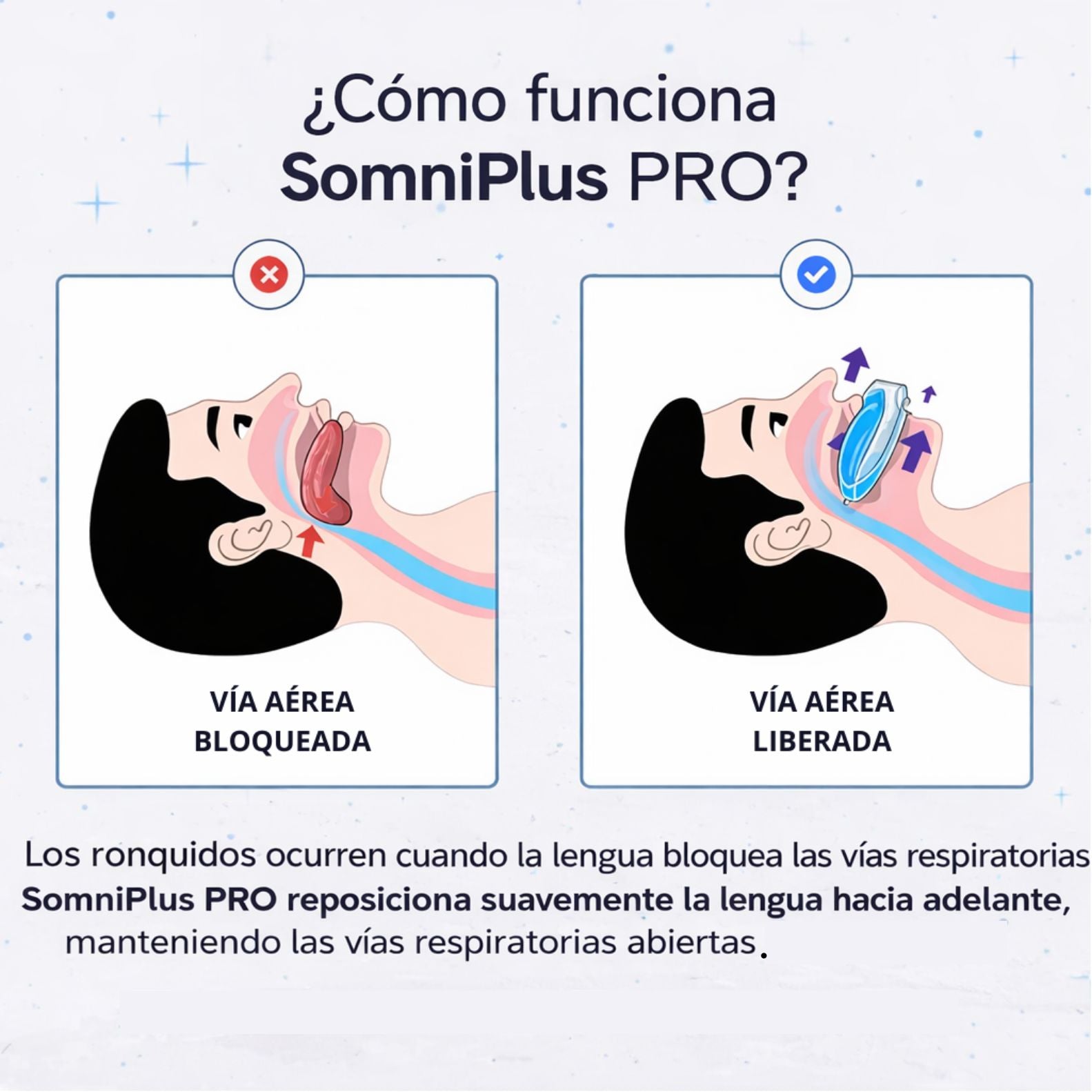 Somniplus Pro - Alivio Inmediato De Los Ronquidos